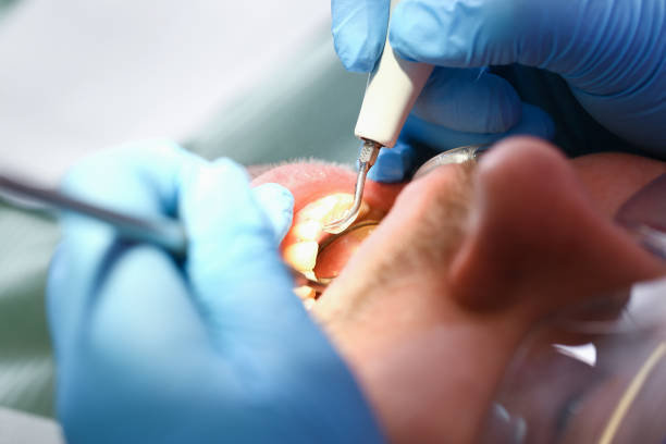 Emergency Gum Pain Relief in WI